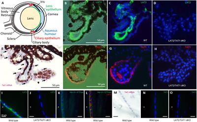 Dysfunctional LAT2 Amino Acid Transporter Is Associated With Cataract in Mouse and Humans